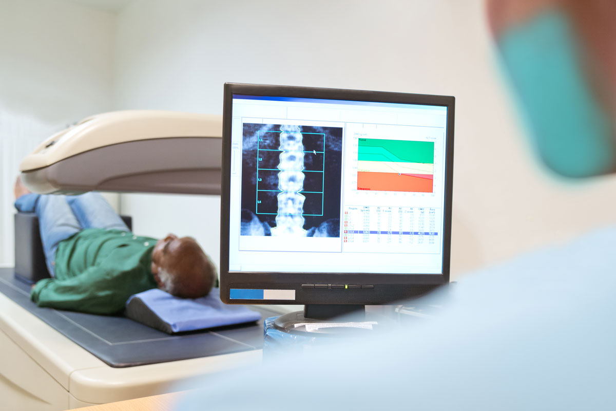 “Skip Bone Density Test? What Every Senior Should Know After 50”