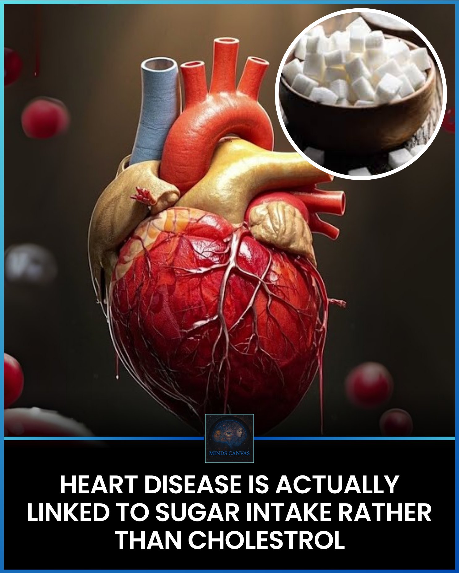 The Sweet Deception: How Sugar, Not Just Cholesterol, Fuels Heart Disease